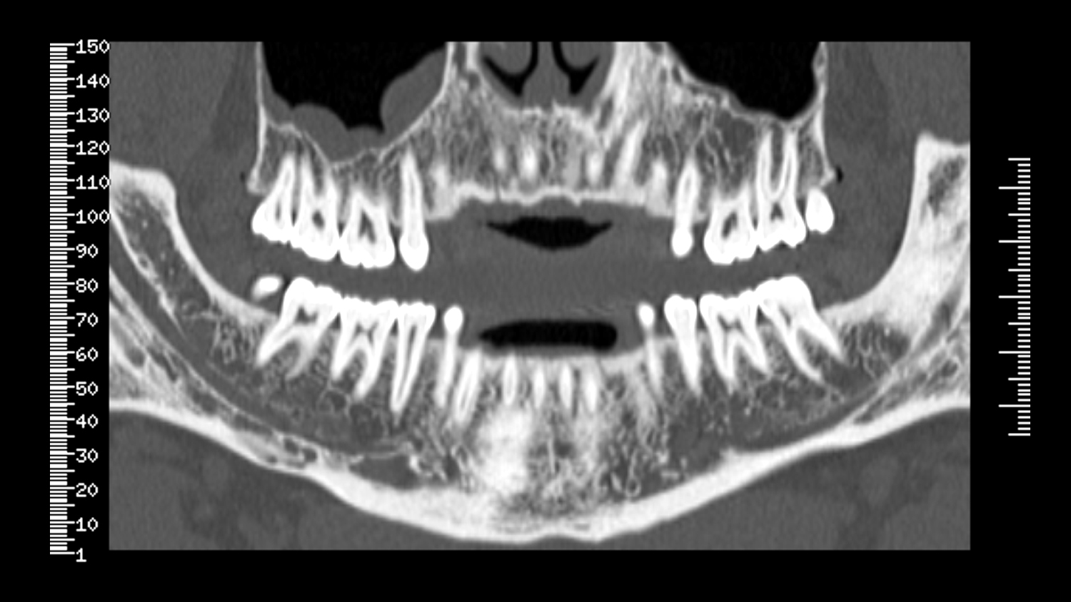 aw-dentascan-clinical3